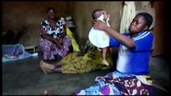 Burkina Faso's 'Miracle Baby' Survives Bullet Wound