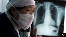 ဘေဂျင်းမြို့တော် ဆေးရုံကြီးမှာ တီဘီရောဂါ ကုသပေးနေတဲ့ တရုတ်ဆရာဝန်နဲ့ လူနာဓါတ်မှန် (AP Photo/Ng Han Guan)