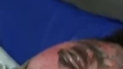 Tibetan Schoolboy Who Set Himself Alight Offers Final Statement