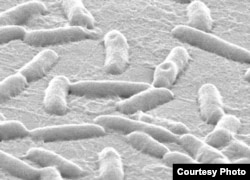 The research targeted Pseudomonas aeruginosa, which causes infection in the lungs, urinary tract, wounds and elsewhere. (Singh Lab, University of Washington)