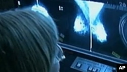 Fewer people are dying of lung or breast cancer, but the occurrence of rare cancers is on the rise in the U.S., according to the American Cancer Society.