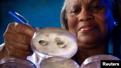 FILE - This undated photo shows a CDC technician making notations on culture plates in which fungal colonies had been grown. The fungus Candida auris has spread to more than 30 countries in the past decade. 