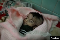 Hajar al-Faqeh, 4 months, who died at the malnutrition ward of al-Sabeen hospital, is seen at the hospital in Sanaa, Yemen, Nov. 15, 2018.