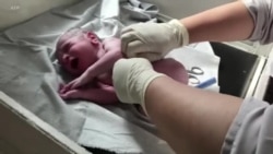 نقش زایشگاۀ خوست در کاهش مرگ و میر مادروان و نوزادان