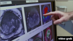 سخنگوی وزارت صحت عامۀ حکومت طالبان اضافه کرد که در حال حاضر، کار ساخت یک شفاخانۀ ۲۰۰ بستر درمان بیماران سرطان در کابل جریان دارد .