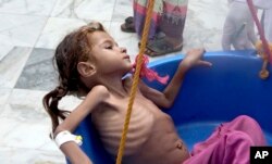 FILE - In this Aug. 25, 2018 file image made from video, a severely malnourished girl is weighed at the Aslam Health Center in Hajjah, Yemen.