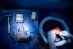 Etika donasi organ didasarkan pada prinsip bahwa donor harus menyumbangkannnya atas kehendak sendiri dan tidak mendapatkan imbalan apa pun. (Foto: ilustrasi)