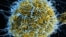 Colorized scanning electron micrograph of filamentous Ebola virus particles (blue) budding from a chronically infected VERO E6 cell (yellow-green) from the National Institute of Allergy and Infectious Diseases. (photo credit: National Institutes of Health)