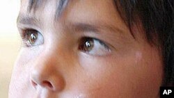 Ansar Deldar, 4, shows signs of leishmaniasis, a common disease among children in Afghanistan.