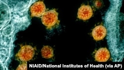 Partikel virus Novel Coronavirus SARS-CoV-2. Mutasi baru COVID-19 yang dinamakan B11529 ditemukan di wilayah Selatan Afrika. (Foto: NIAID/National Institutes of Health via AP)