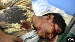 Seorang demonstran yang terluka akibat bentrokan di Taiz, Senin (4/4), dirawat di rumah sakit darurat.