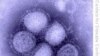 Health Officials Report 7 Swine Flu Deaths in Iraq