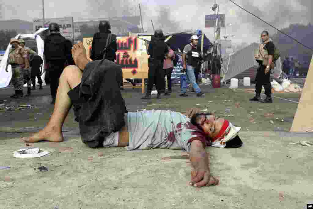Seorang demonstran yang terluka dalam bentrokan dengan pasukan keamanan Mesir di Kairo.&nbsp;(AP/Imad Abdul Rahman)