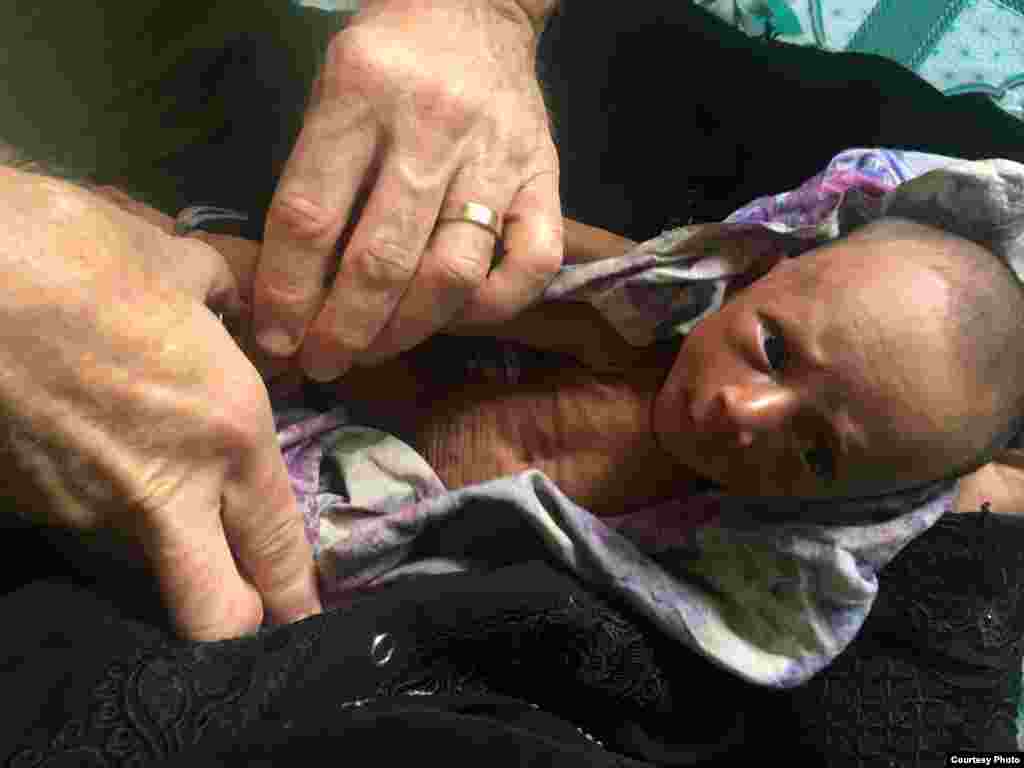 A sick baby is seen at a Rohingya refugee camp in Bangladesh. (Photo courtesy of Dr. Imran Akbar)