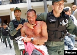 An injured government supporter is taken away by security forces after he and a group of fellow government supporters burst into Venezuela's opposition-controlled National Assembly during a session, in Caracas, Venezuela, July 5, 2017.