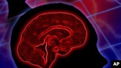 Patients may be more likely to survive a stroke if ambulance crews take them to a certified stroke facility, a new study finds.