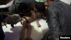 FILE - A child is treated in a hospital in Douma, eastern Ghouta, near Damascus, Syria, after a suspected chemical weapons attack April, 7, 2018. (White Helmets handout via Reuters) 