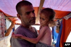 Hana Abdelrahaman al-Rai, a 4-year-old suffering from malnutrition and displaced from Gaza City, reacts as she is carried outside a tent in Zawayda in the central Gaza Strip on June 4, 2024.