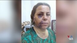 داستان سرکوب جمهوری اسلامی در جنبش مهسا؛ مادری با ساچمه‌هایی در سر و پدری ناپدید شده