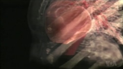 Good Heart, Brain Health Plus Education Equals Lower Risk For Dementia