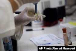 FILE - Blood samples from pregnant women are analyzed for the presence of the Zika virus, at Guatemalan Social Security maternity hospital in Guatemala City, Feb. 2, 2016.