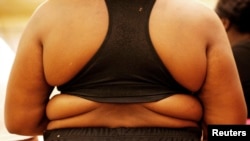 FILE - A new study suggests a gene shown to strongly influence obesity is more potent among people born after 1942.