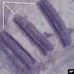 Satellite Image of alleged mass graves in Kadugli in Sudan's South Kordofan State, July 2011