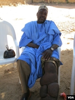 Hamisu Isa has suffered from lymphatic filariasis, or elephantiasis, for more than two decades. (VOA/P. Graitcer)