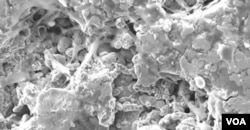 Bone cells attach to 3-D-printed scaffolding. When bone completely heals the material will degrade. (University of Pittsburgh)