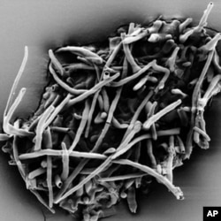 Scanning electron micrograph of fossil ectomycorrhiza which leached out of the amber fragment.