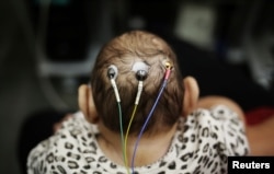 FILE - Five-month-old Laura undergoes a medical test at the University of Sao Paulo (USP) in Sao Paulo, Brazil, April 28, 2016.