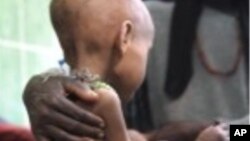 Okule Buli helps her five-year old daughter Jamila sit up in her bed in the Intensive Care Unit of a medical center run by Medecins Sans Frontiers in Kuyera, Ethiopia, 02 Sep 2008 (File photo AFP)