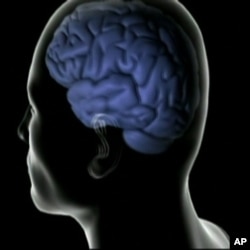 Researcher Owen Carmichael says most people develop vascular disease as they age, which affects blood flow to the brain.