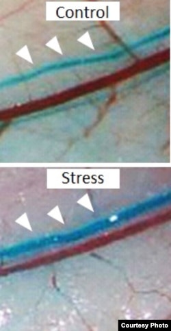 Image of green spheres flowing through lymph vessels of mice that are not stressed (top) or stressed (bottom) (Le et al., Nature Communications)