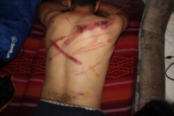 Migrant kojeg je navodno pretukla hrvatska policija