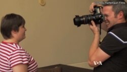 Photography Turns Lens to People with Genetic Conditions