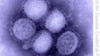 FILE - An image of H1N1 influenza virus from the U.S. Centers for Disease Control and Prevention.