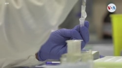 Pandemia “X” ¿Estamos preparados?