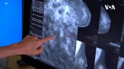 Вештачката интелигенција покажала попрецизни резултати во откривањето рак