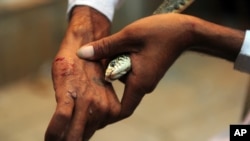 FILE - A snake charmer points out a snakebite during a performance with a snake outside a temple in Allahabad, India.