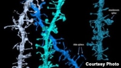 3D images of synapses that shrink during sleep. Credit: Wisconsin Center for Sleep and Consciousness