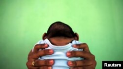 Criança com microcefalia, Recife, Brasil