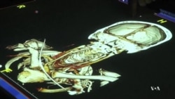 New Technology Gives Surgeons Unprecedented Views of Patients’ Bodies