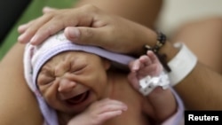 FILE - A mother holds her daughter, who has microcephaly, at a hospital in Recife, Brazil, Jan. 28, 2016.