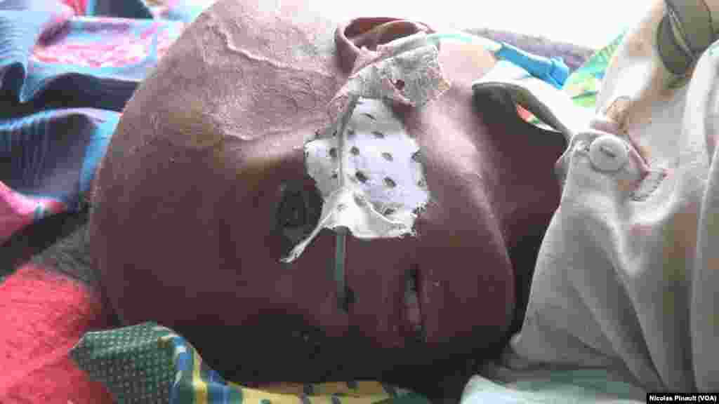 Wani yaro dake fama da matsalar yunwa. Afirilu 18, 2017 (VOA/Nicolas Pinault)