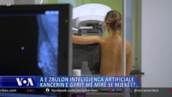 A e zbulon inteligjenca artificiale kancerin e gjirit më mirë se mjekët?