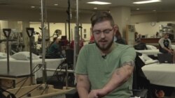 Що відчуває людина з трансплантованими руками. Відео