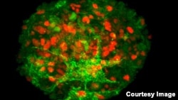 Spheres of cultured papillae cells from human hair follicles successfully produced new human hair when transplanted between the dermis and epidermis of human skin. (Claire Higgins/Christiano Lab at Columbia University Medical Center)
