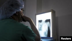 A doctor from an international cardiac mission examines the x-ray of a patient's heart in the Degand Clinic in Port-au-Prince, Haiti, April 15, 2012. 
