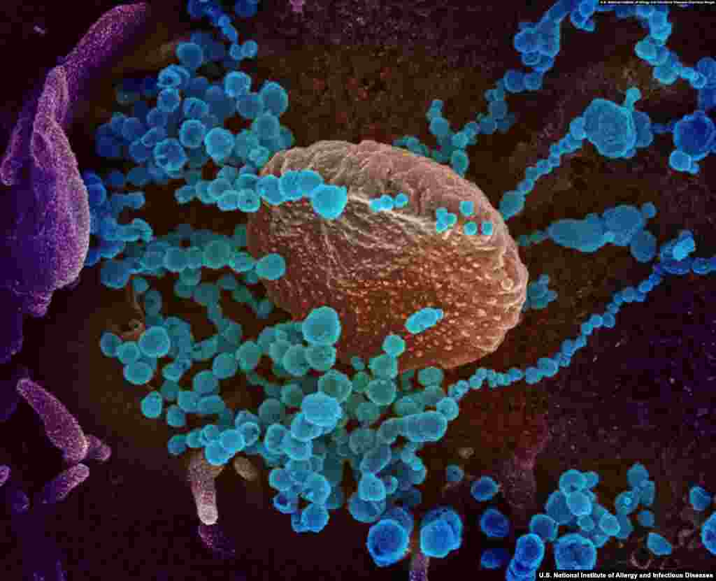 SARS-CoV-2 virions emerging from a human cell. All photos in this gallery were colorized using either feature-detection software or Photoshop. (Courtesy: U.S. National Institute of Allergy and Infectious Diseases)